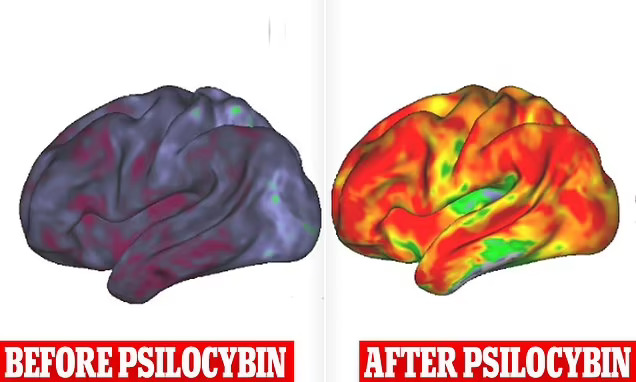 2024-07-21
神經科學家 尼科 · 多森巴赫博士報告說，當藥物 psilocybin 生效...